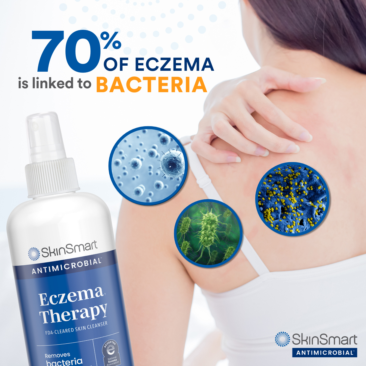 SkinSmart Antimicrobial Eczema Therapy