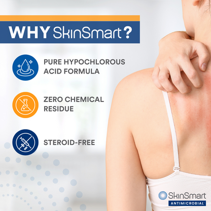 SkinSmart Antimicrobial Eczema Therapy