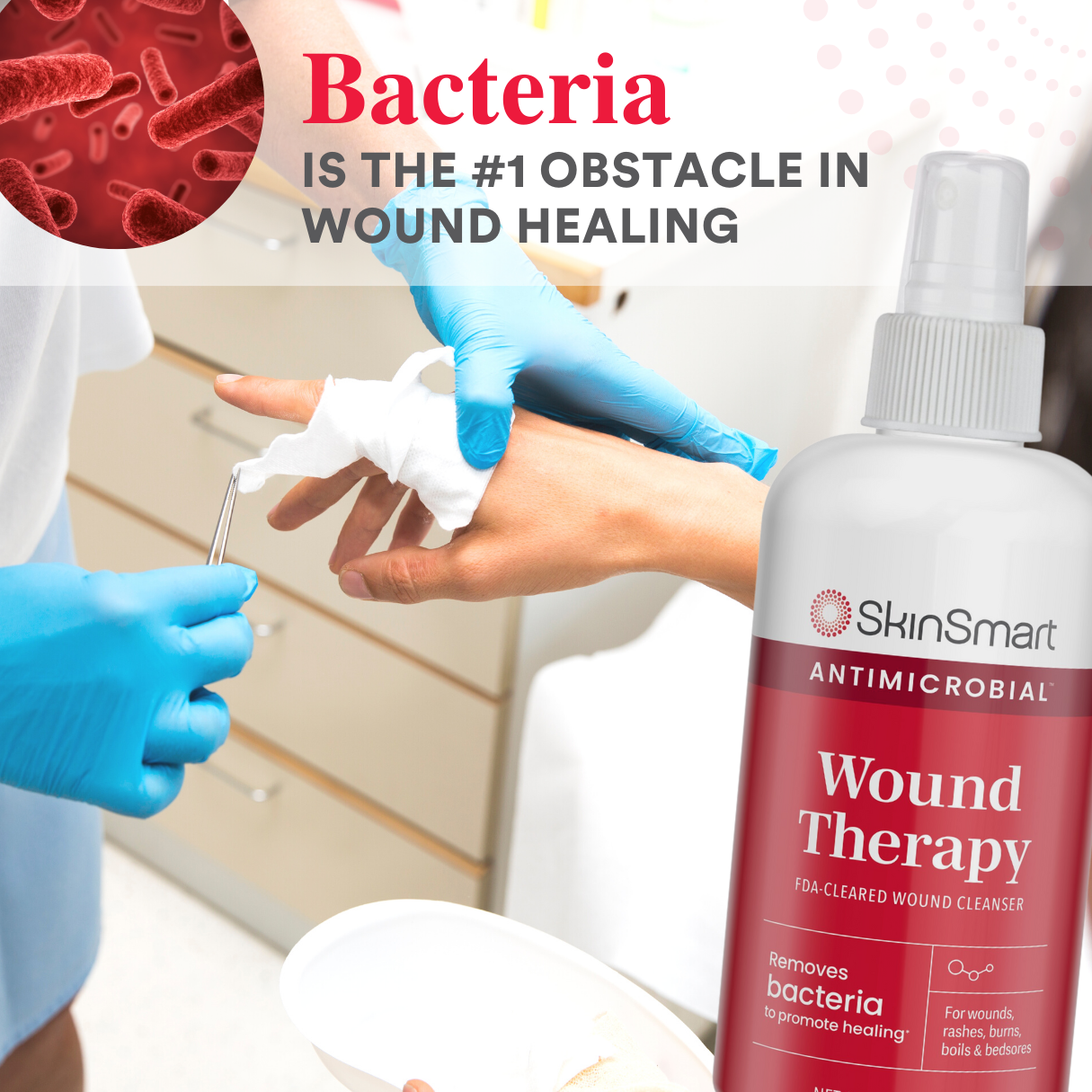 SkinSmart Antimicrobial Wound Therapy