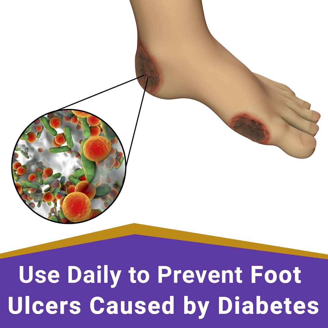 SkinSmart Daily Foot Cleanser for At-Risk Feet