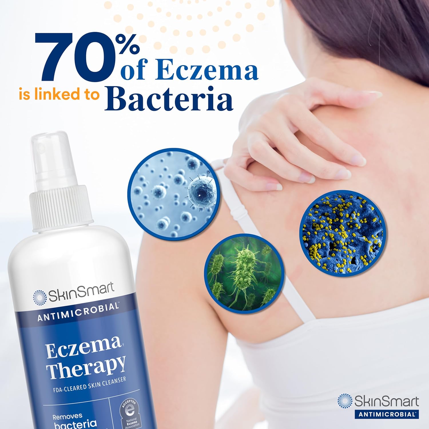 SkinSmart Antimicrobial Eczema Therapy with Hypochlorous Acid