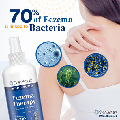 SkinSmart Antimicrobial Eczema Therapy with Hypochlorous Acid